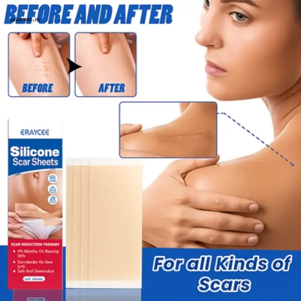 Deramed Silicone Sheet For Treatment 1