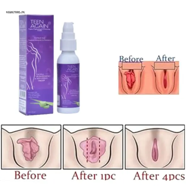 Teen Again Vaginal Tightening & Whitening Cream 1